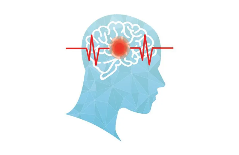 Understanding the Main Causes of Stroke: Insights from the Best Neurologist in Delhi