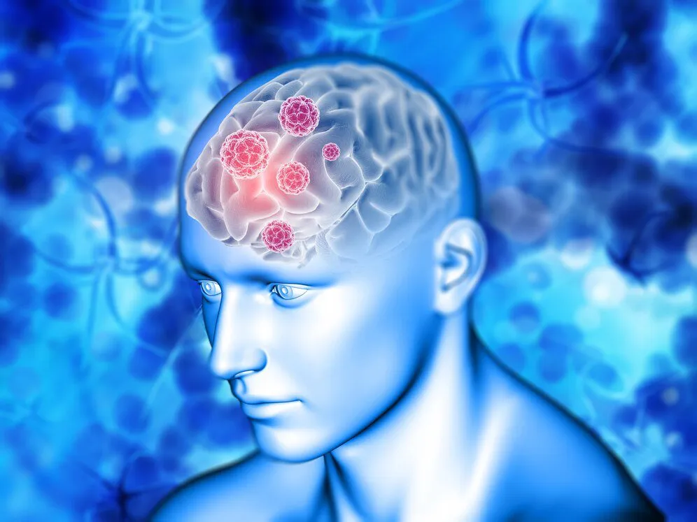 Myths and Facts About Neurological Diseases You Should Know