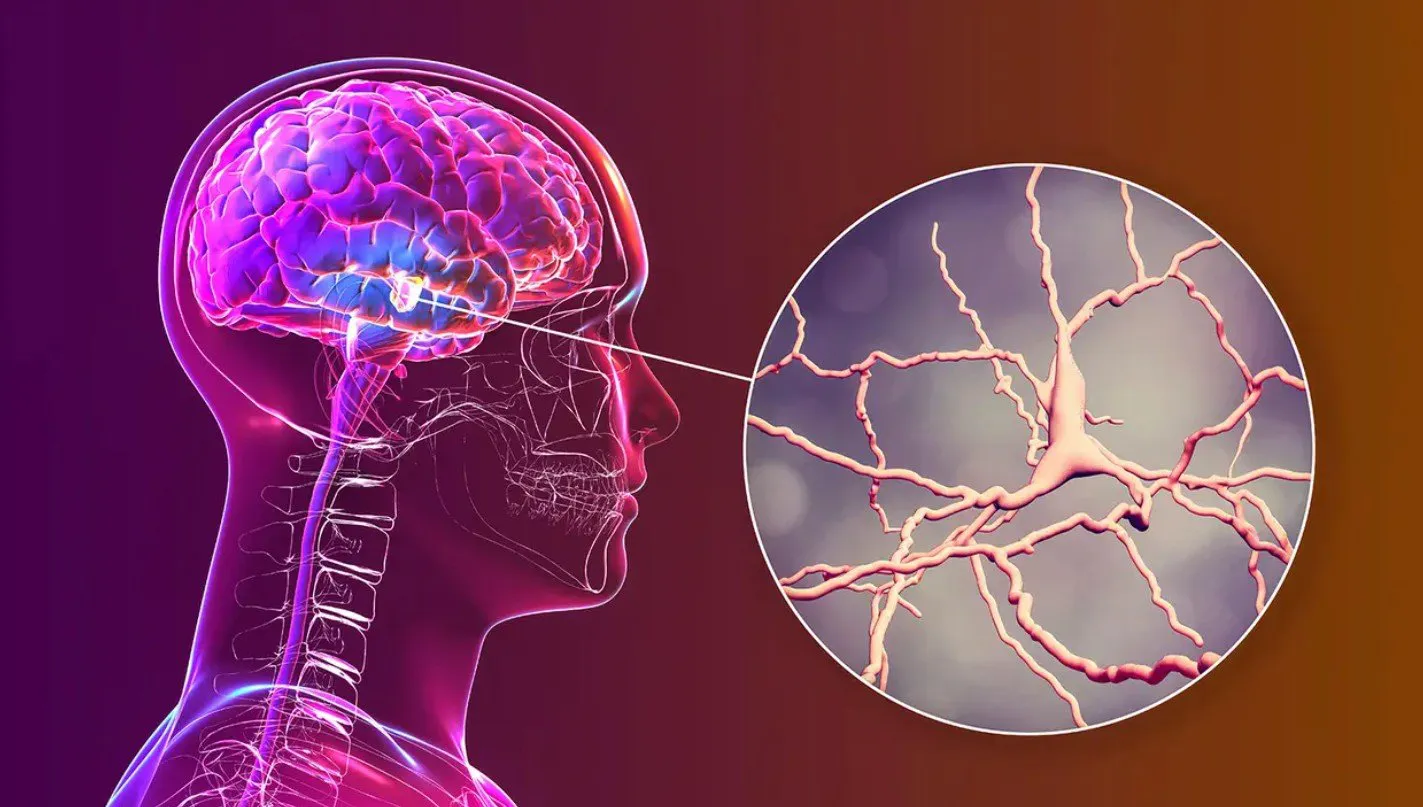 Parkinson’s Disease Treatment in Delhi NCR: Why Early Diagnosis Matters