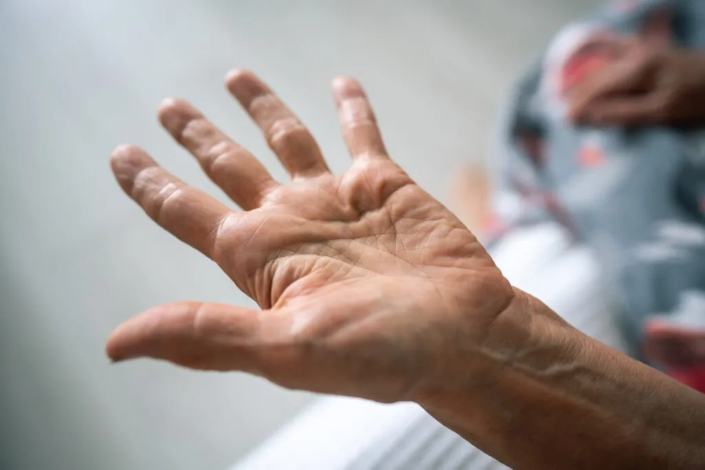 Living Better with Parkinson’s: Tips from a Leading Neurologist in Delhi NCR